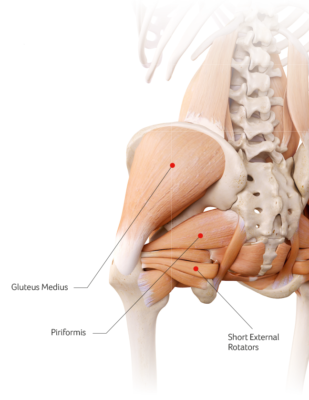Total Hip Replacement Santry Dublin 9