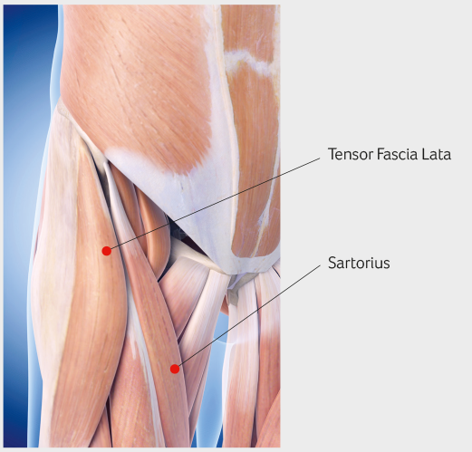 Labral tear Hip Dublin