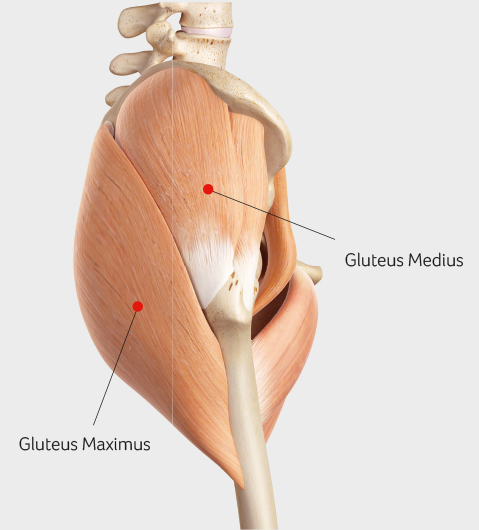 GLUTEUS MEDIUS TENDINOPATHY at UPMC Sports Surgery Clinic Dublin