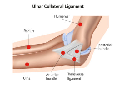 Elbow Instability UPMC Sports Surgery Clinic