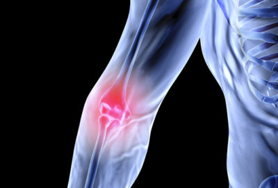 Elbow Surgery Santry